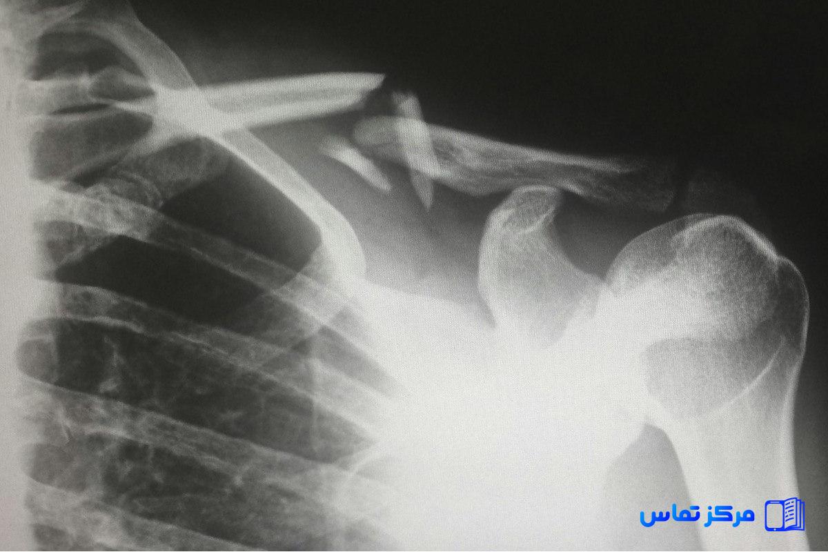 استخدام پزشک ارتوپد در کشور ترکیه شهر استانبول