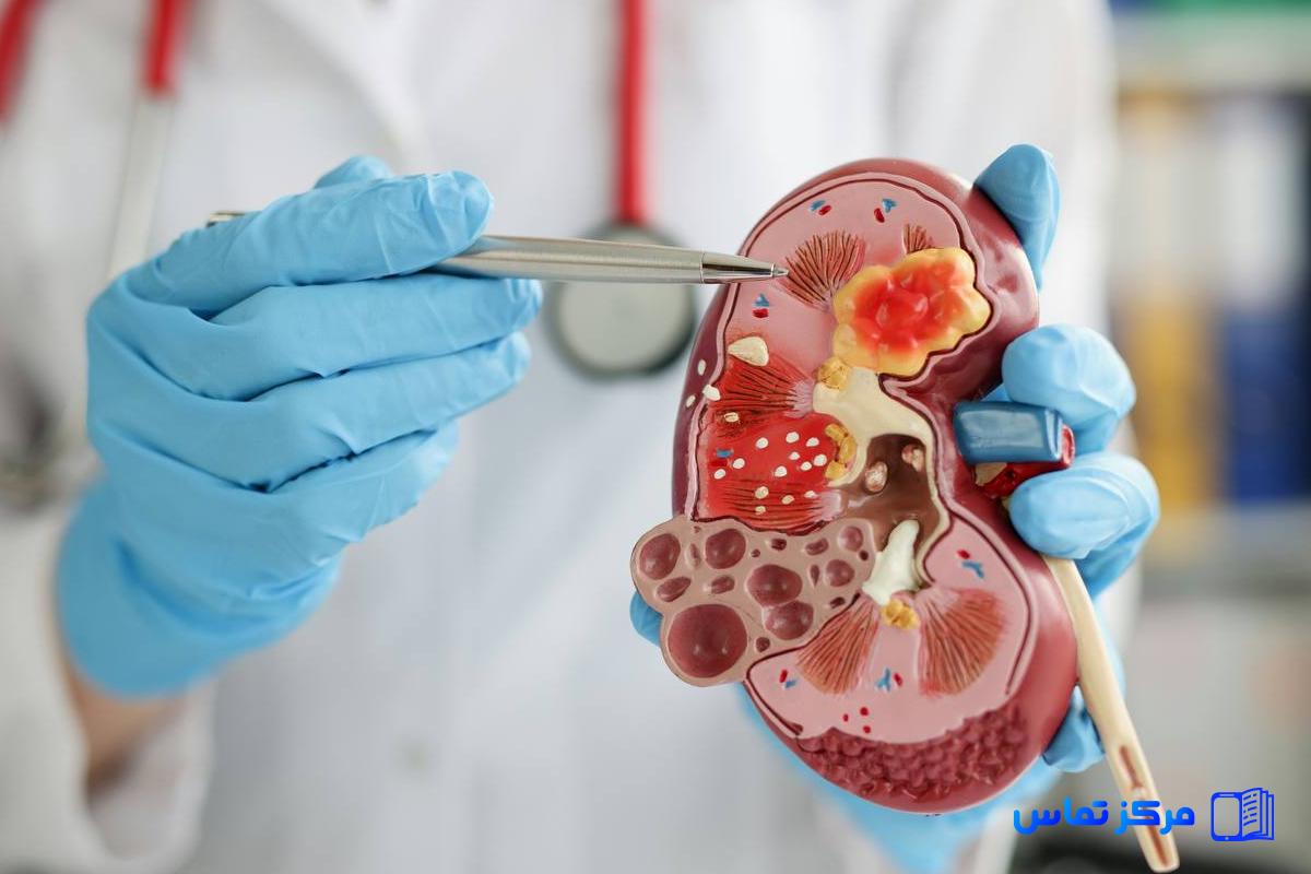 استخدام پزشک  فوق تخصص نفرولوژی در کشور ترکیه شهر استانبول