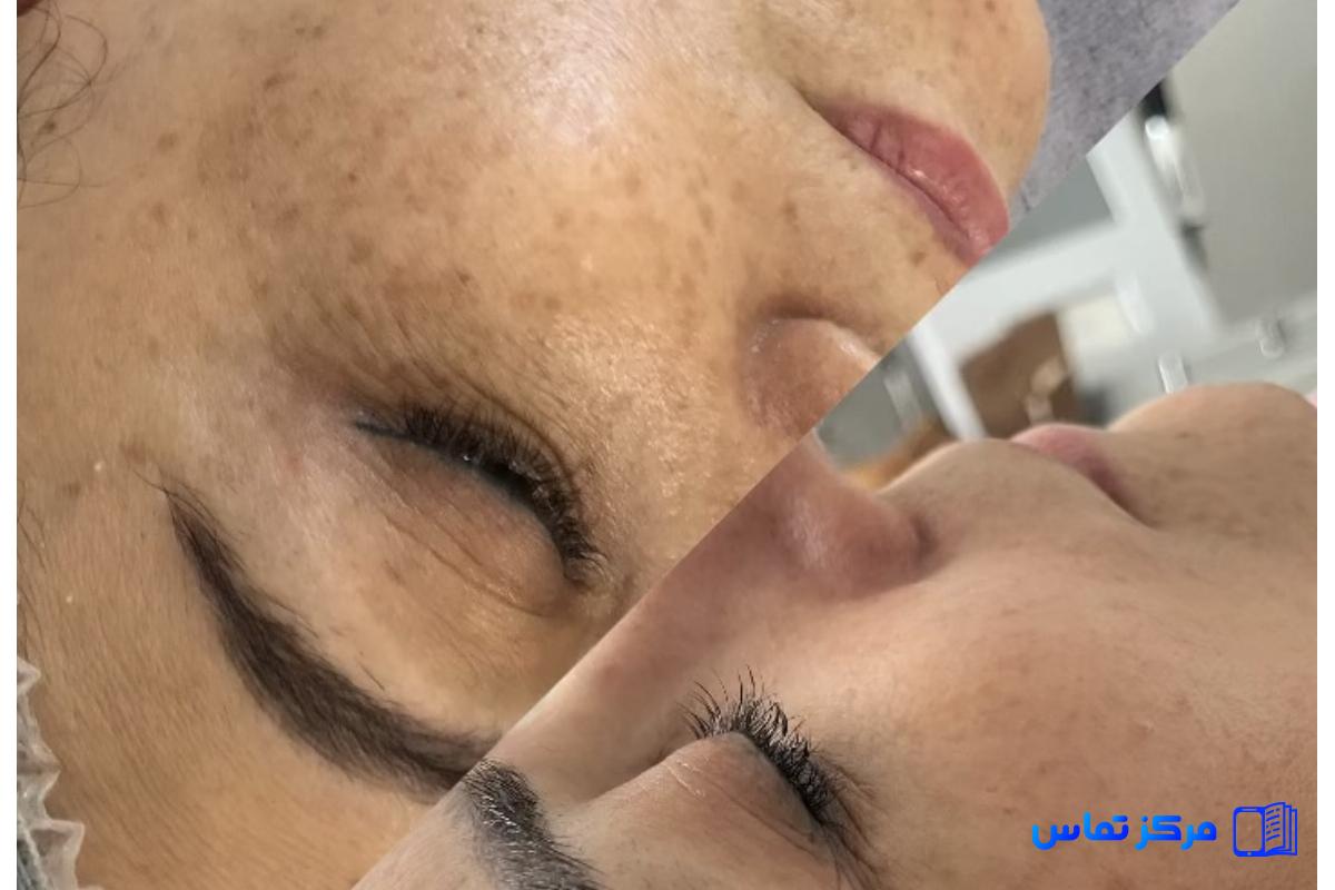 جویای کار در کیلینیک و سالن های زیبایی دبی هستم